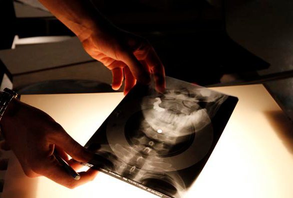 X-ray record