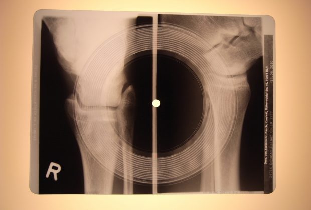 X-ray record