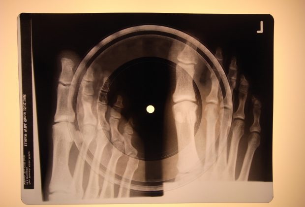 X-ray record